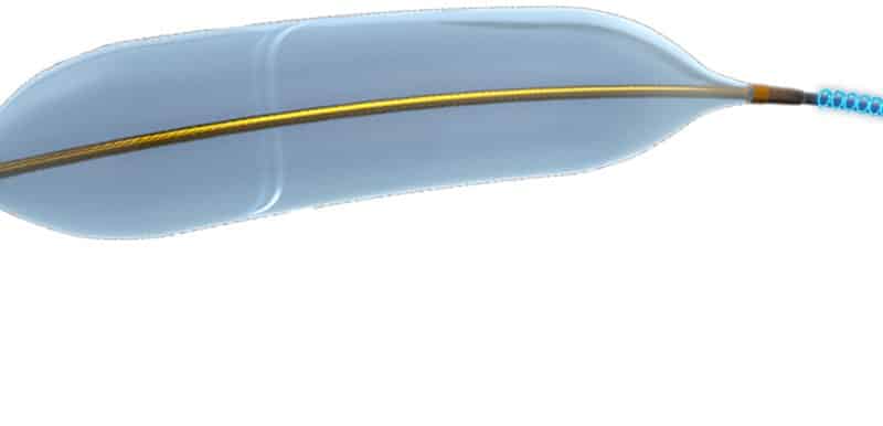 An illustration of the balloon catheter technology that Amplitude Vascular Systems (AVS) uses to break up calcium buildups in arteries.
